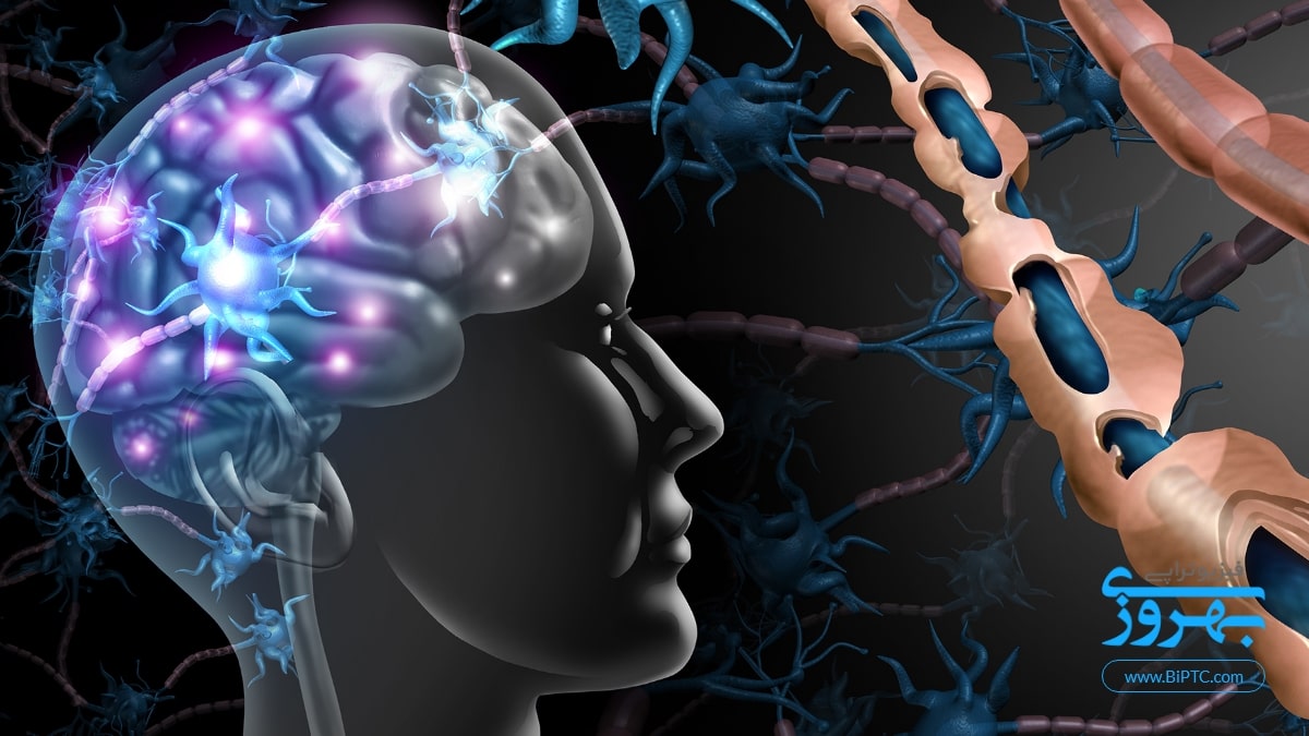 ام اس یا مالتیپل اسکلروزیس